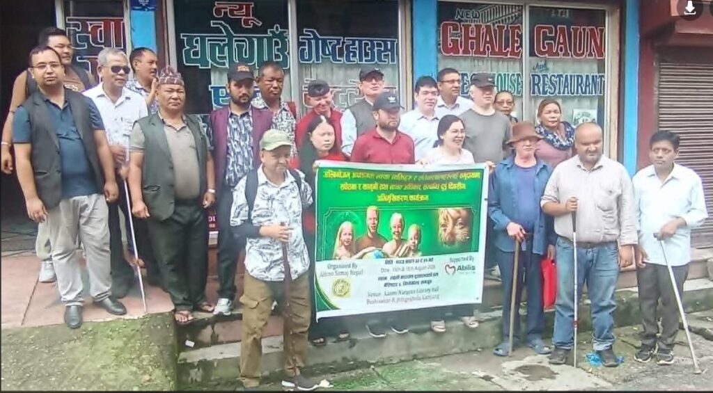 अल्बिनो अपाङ्गताका जन्मजात समस्या हो, यसको कारण आँखाको ज्याति स्वतः कमजोर हुन्छ 